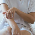 Woman with rash or papule and scratching arm from allergies Woman with rash or papule and scratching arm from allergies