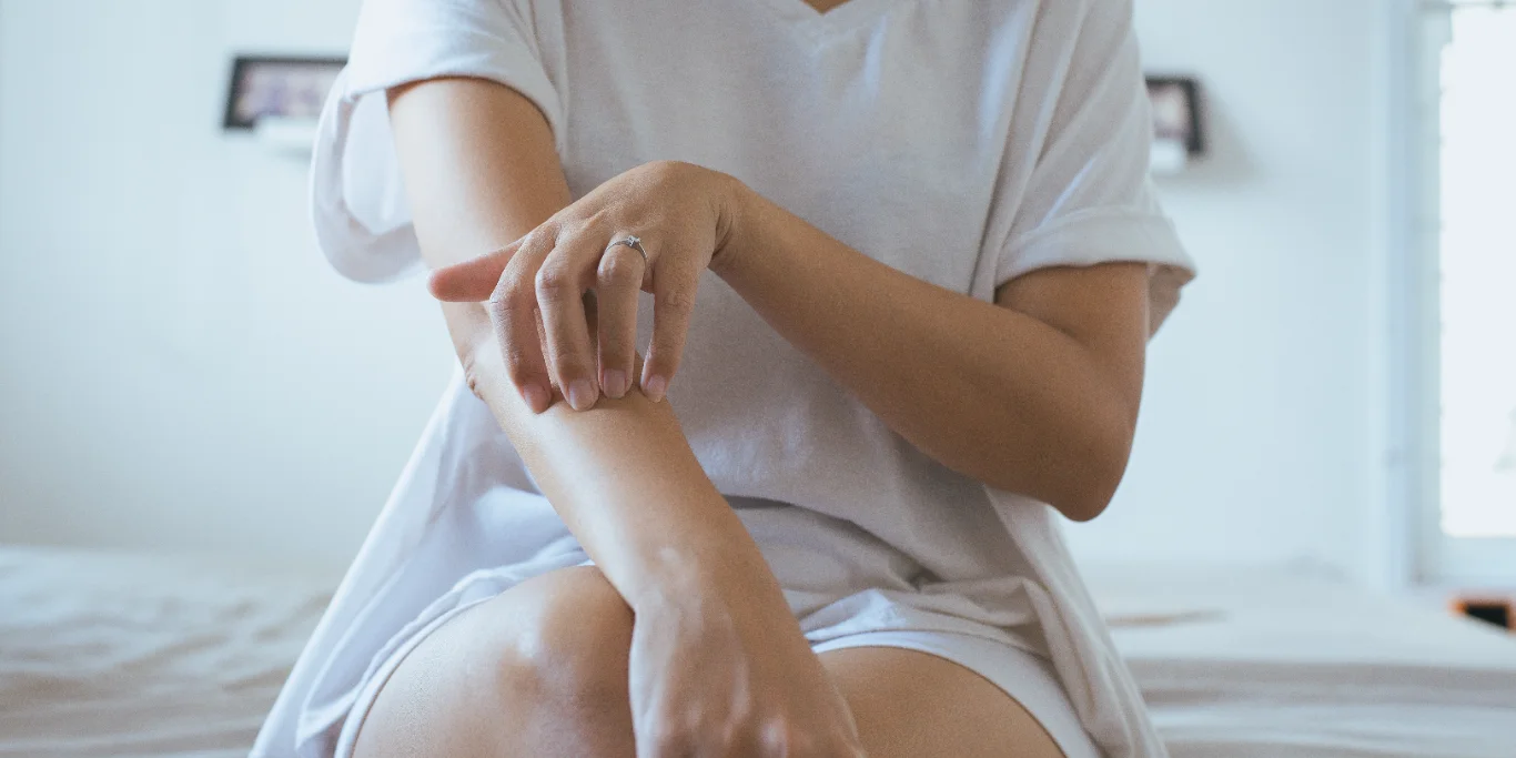 Woman with rash or papule and scratching arm from allergies